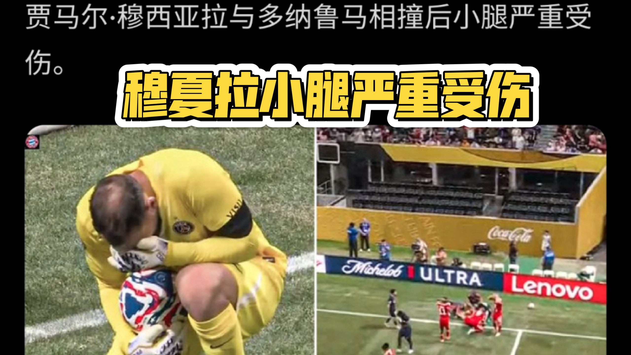 拜仁慕尼黑阵中重要球员因伤缺席的简单介绍